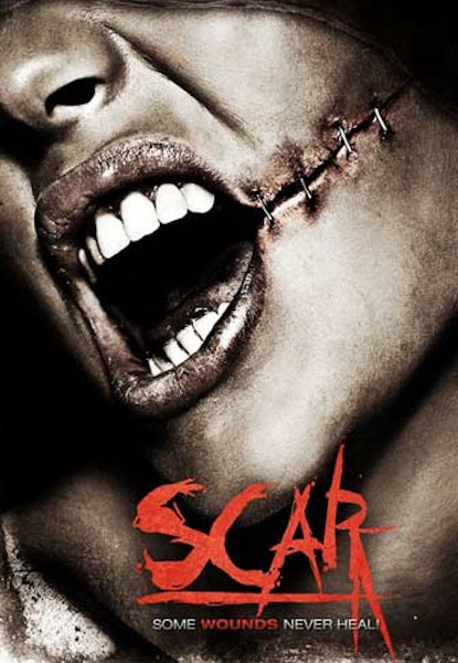 Scar
